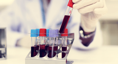 Why are Mustang Bio shares (MBIO) up almost 500%?